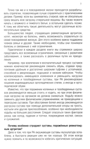 Повседневная жизнь с ревматоидным артритом — фото, картинка — 3