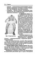 Терапия — фото, картинка — 18