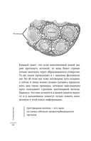 Страсти по щитовидке. Аутоиммунный тиреоидит, гипотиреоз: почему иммунитет работает против нас? — фото, картинка — 12