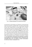 Респираторная поддержка как по нотам. С точки зрения физиологии пациента и доказательной медицины — фото, картинка — 69