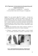 Респираторная поддержка как по нотам. С точки зрения физиологии пациента и доказательной медицины — фото, картинка — 80