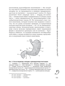 Язвенная болезнь. Факторы риска, симптомы, лечение и диета — фото, картинка — 12