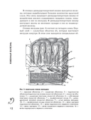 Язвенная болезнь. Факторы риска, симптомы, лечение и диета — фото, картинка — 13