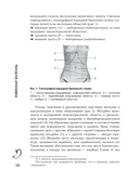 Язвенная болезнь. Факторы риска, симптомы, лечение и диета — фото, картинка — 11