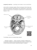 Живая остеопатия. Системный подход к лечению явных и скрытых заболеваний — фото, картинка — 13