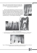 Терапевтическая стоматология. Клиническая эндодонтия — фото, картинка — 7